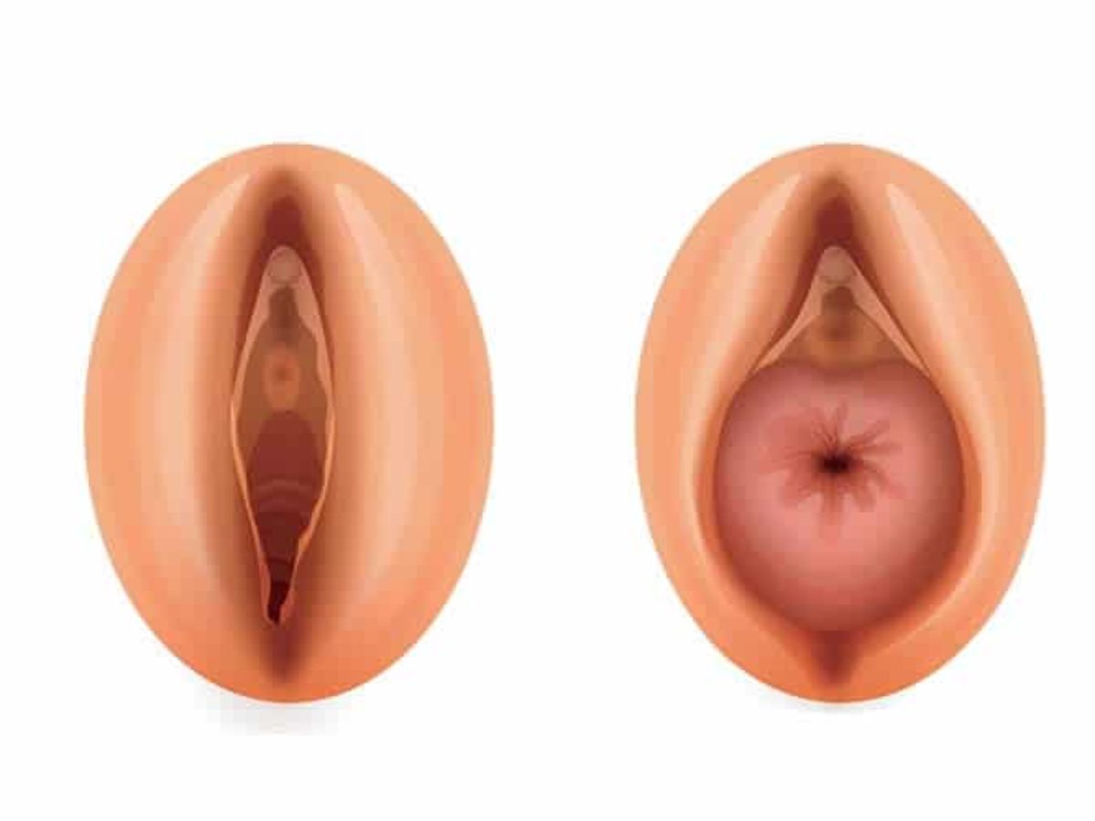 Divas anatomiskas ilustrācijas, kas attēlo vulvu un maksts struktūru. Rīgas 1. slimnīca.