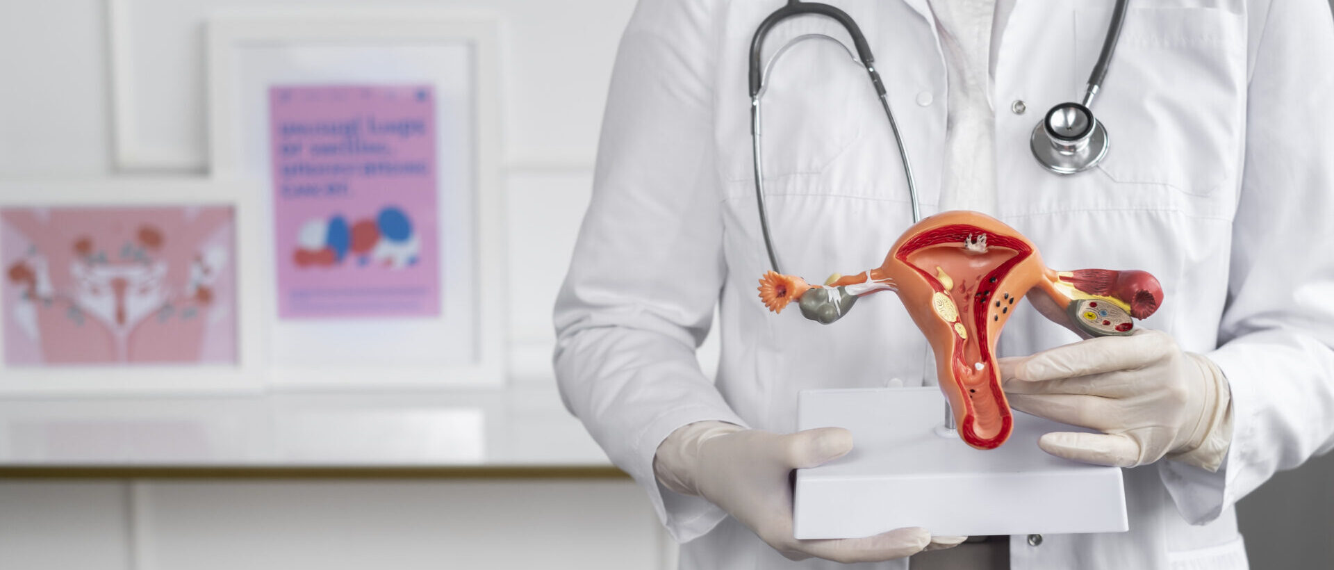 Ārsts tur ginekoloģisko modeli, kas attēlo dzemdi un olnīcas, fons ar medicīnas plakātiem.