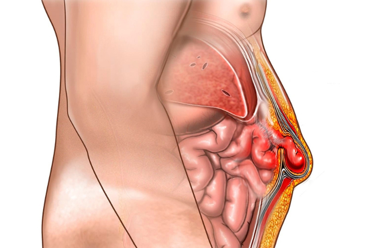 Anatomiska ilustrācija, kas parāda cilvēka ķermeņa iekšējos orgānus, tostarp aknas un zarnu sistēmu.