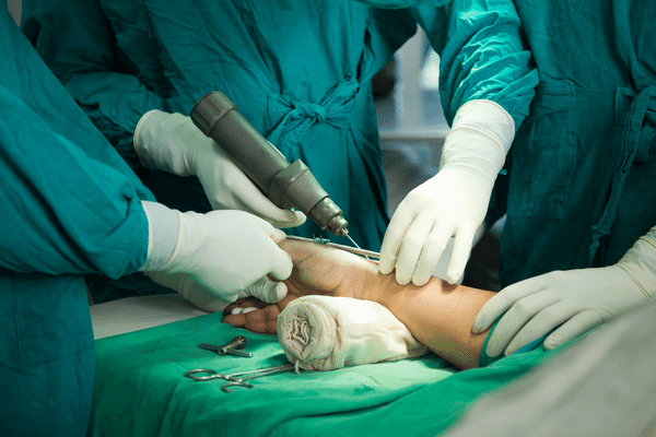 Ķirurģiska procedūra, kurā tiek izmantots instruments uz pacienta rokas, apkārt ir medicīnas personāls.