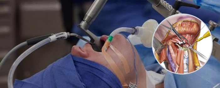 Pacients operācijas laikā ar anesteziju, blakus attēls ar ķirurģisko procedūru un muskuļu anatomiju.