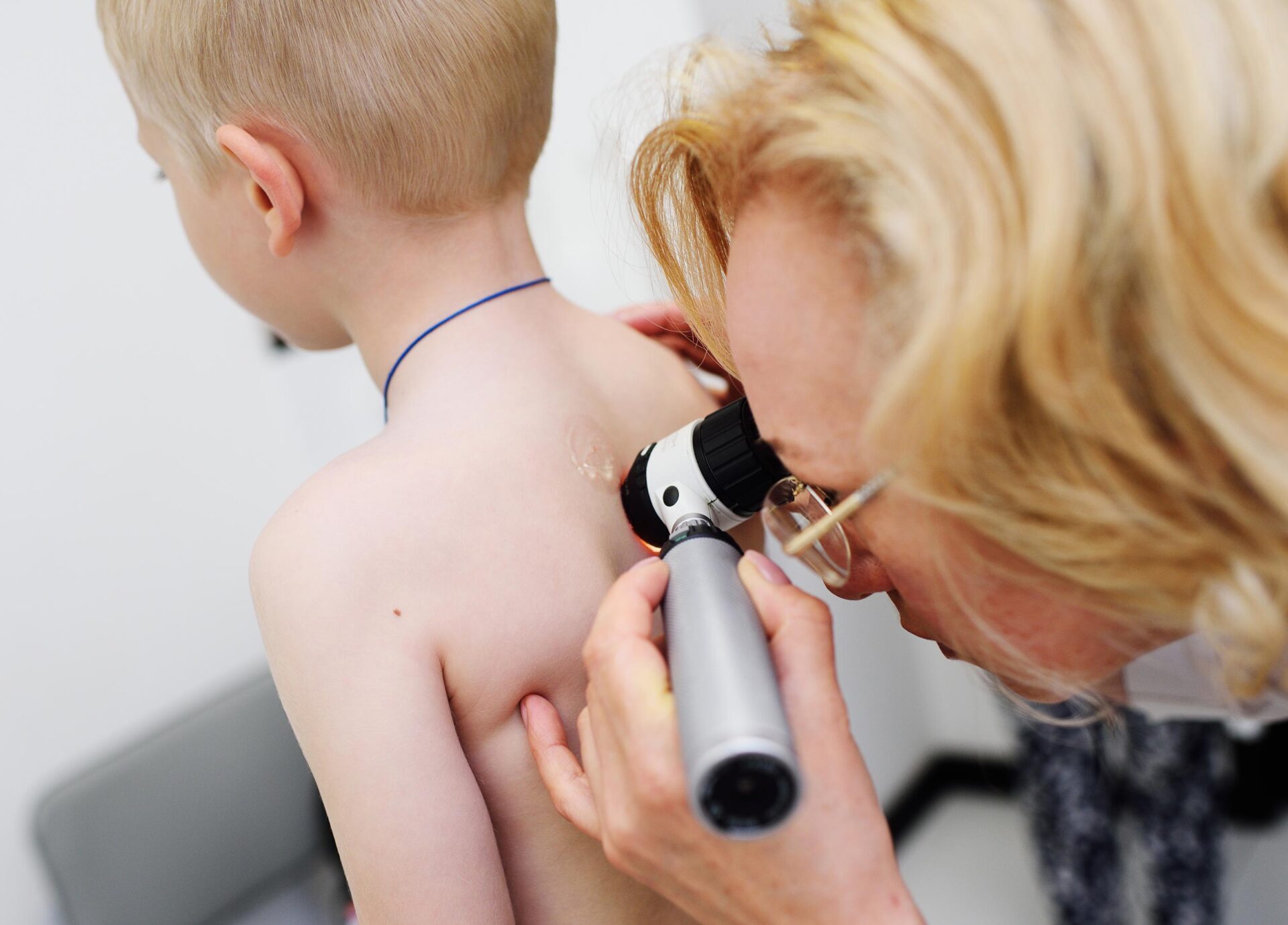 dermatologs pārbauda bērna ādu uz muguras ar dermatoskopu ādas slimību diagnostikai