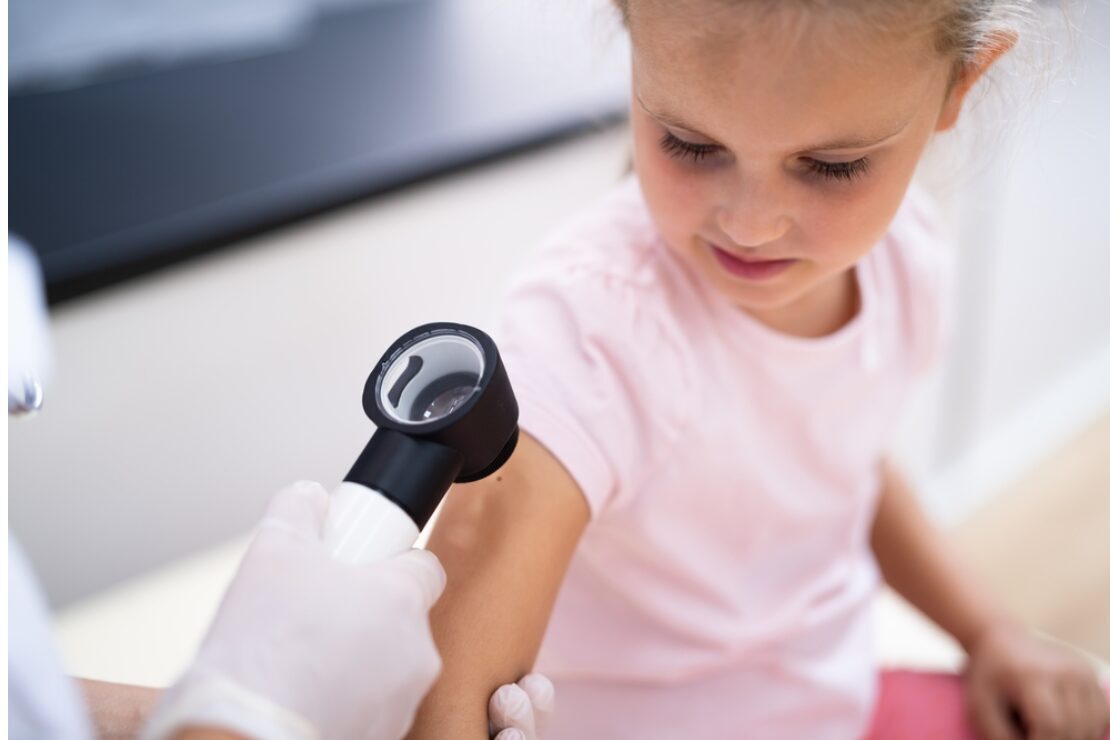 dermatologa konsultācija bērnam ar dermatoskopiju ādas veidojumu diagnostikai