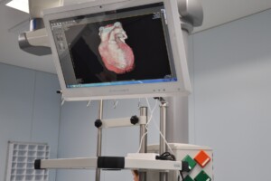 Ekrānā redzams 3D attēls par sirdi medicīnas telpā Rīgas 1. slimnīcā.