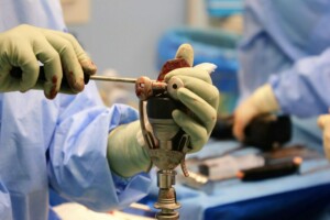 Ārsts ar zaļām cimdiem strādā ar medicīnisko instrumentu operācijas laikā. Redzams asinis uz instrumenta.