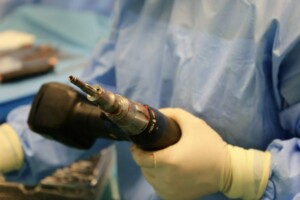Ārsts tur medicīnisko instrumentu ar asins pēdām, valkājot vienreizējās cimdi un zilu operāciju apģērbu.