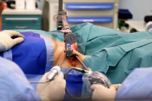 Operācija ar medicīniskiem instrumentiem, redzama brūce un sterili apģērbi. Rīgas 1. slimnīca.