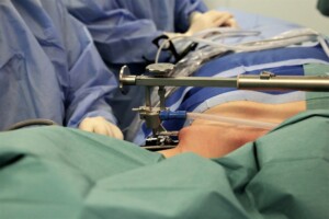 Operācijas telpa ar medicīnas personālu un instrumentiem, pacients ar operācijas laukumu.