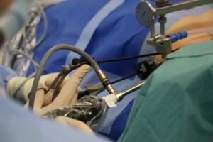 Ķirurģiska procedūra, kurā redzama roka ar instrumentiem uz zila operāciju galda.